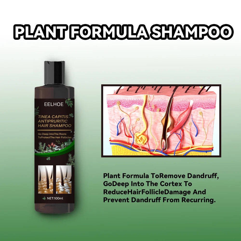 Anti dandruff Shampoo