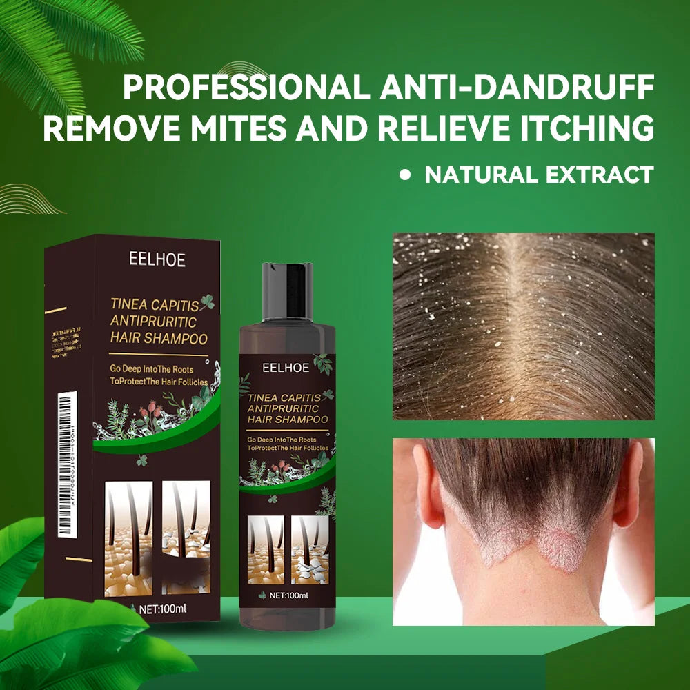 Anti dandruff Shampoo