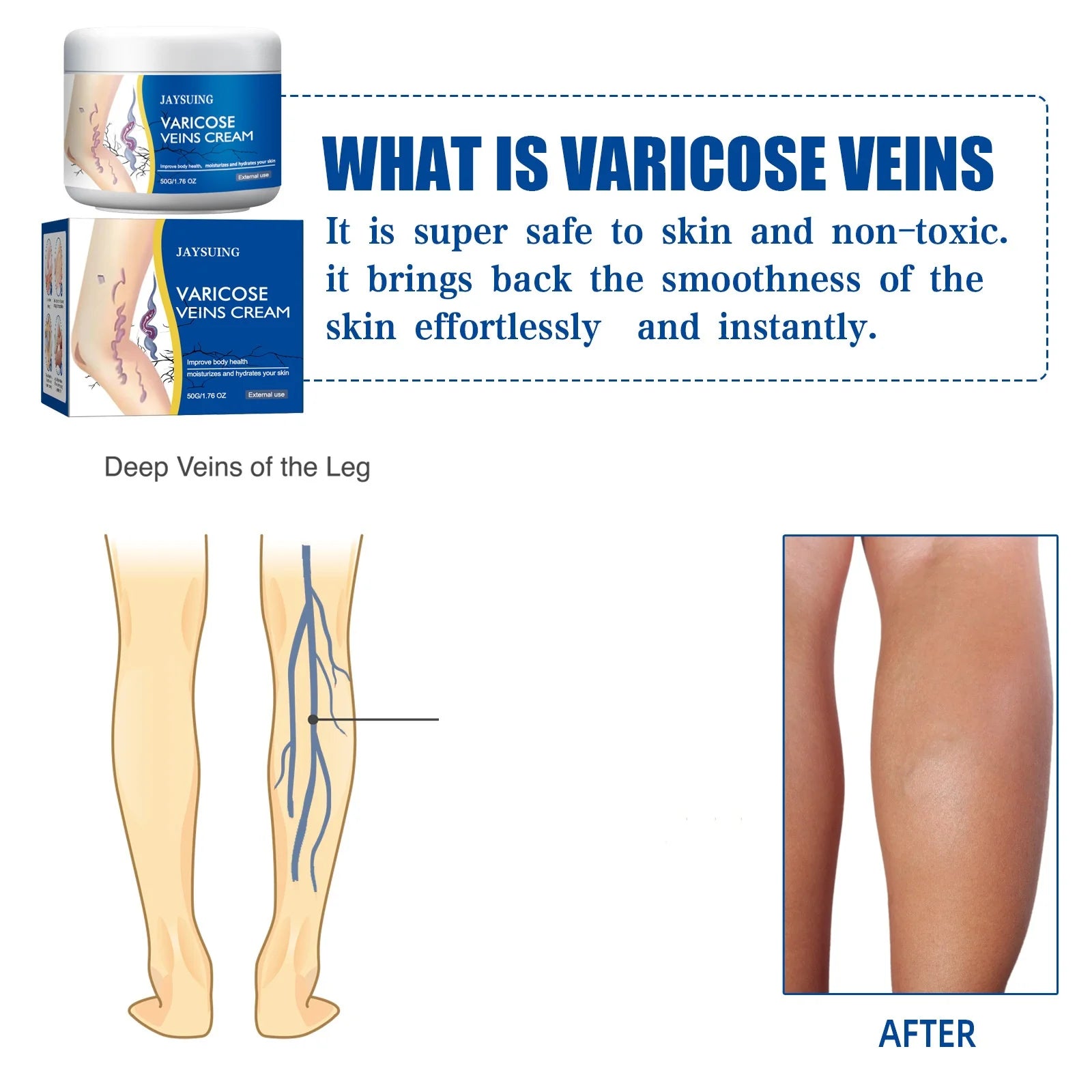 Jaysuing Herbal Relief Cream  Unisex Body Moisturizer Nourishing, Original Scent, Varicose Spider Treatment