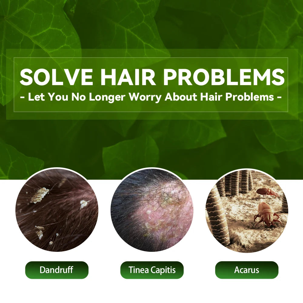 Anti dandruff Shampoo