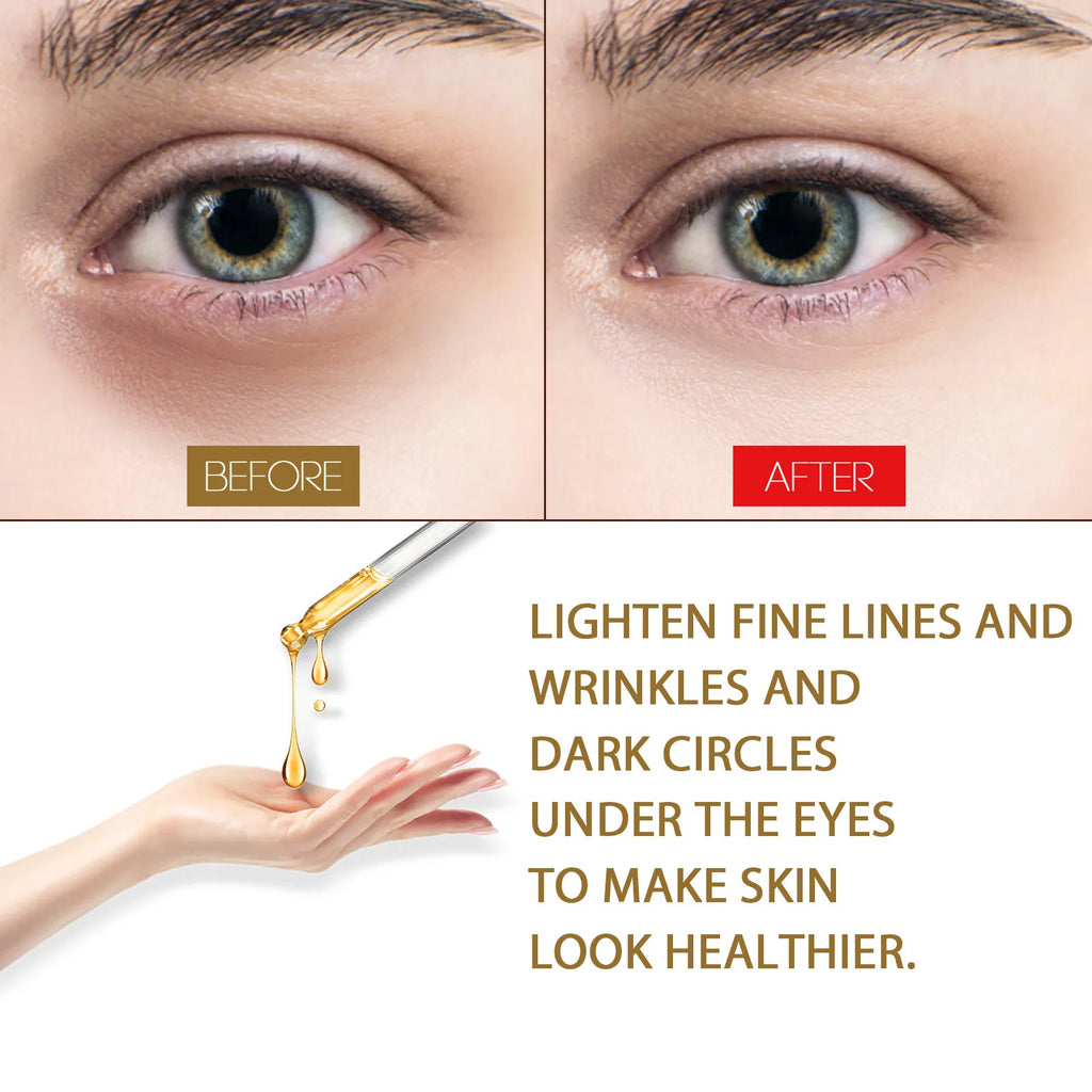 Eye Serum for Dark Circles