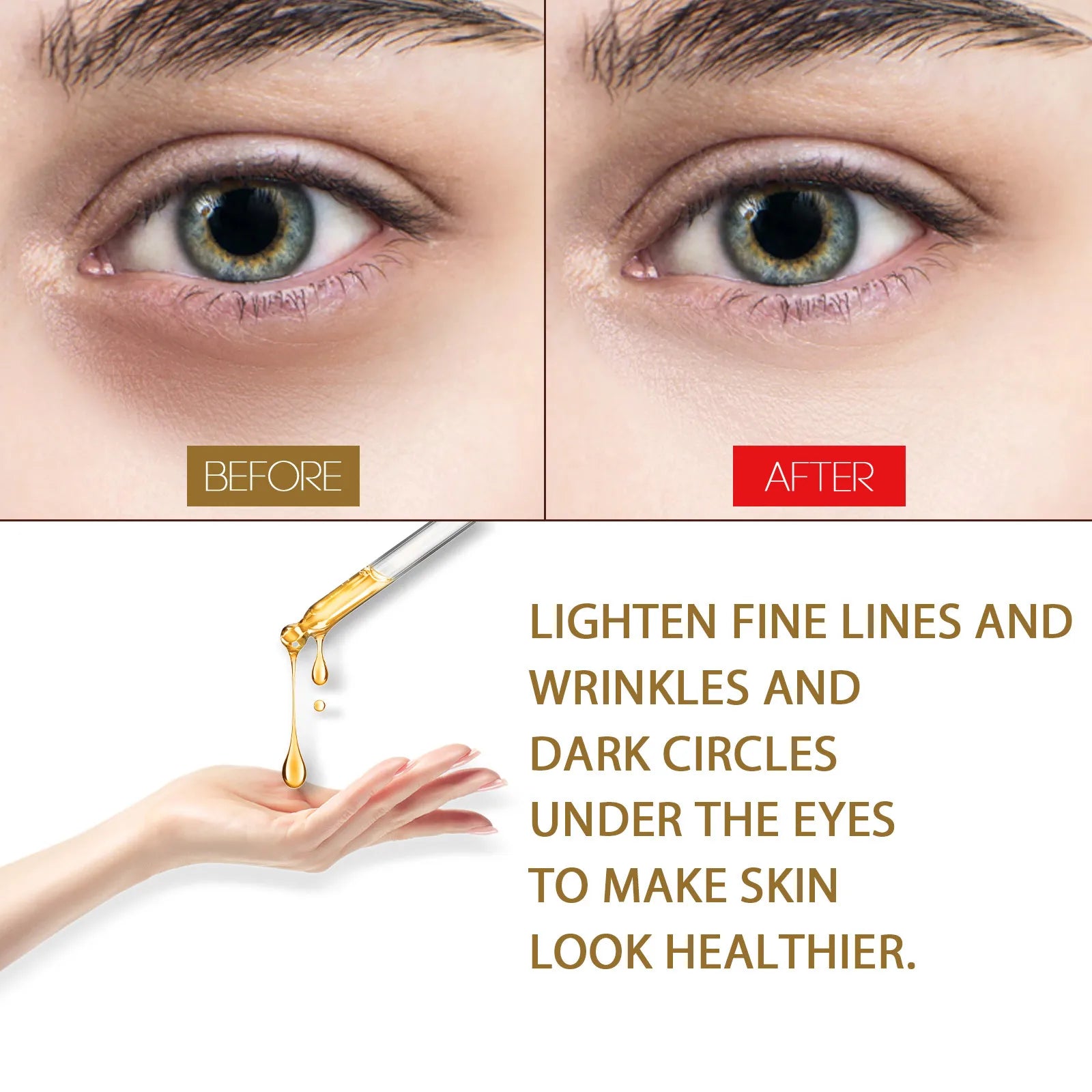 Eelhoe Anti-Aging Eye Serum for Dark Circles Pore Minimization Fine Line Reduction And Eye Bag Elimination Youthful Eye Care Essence