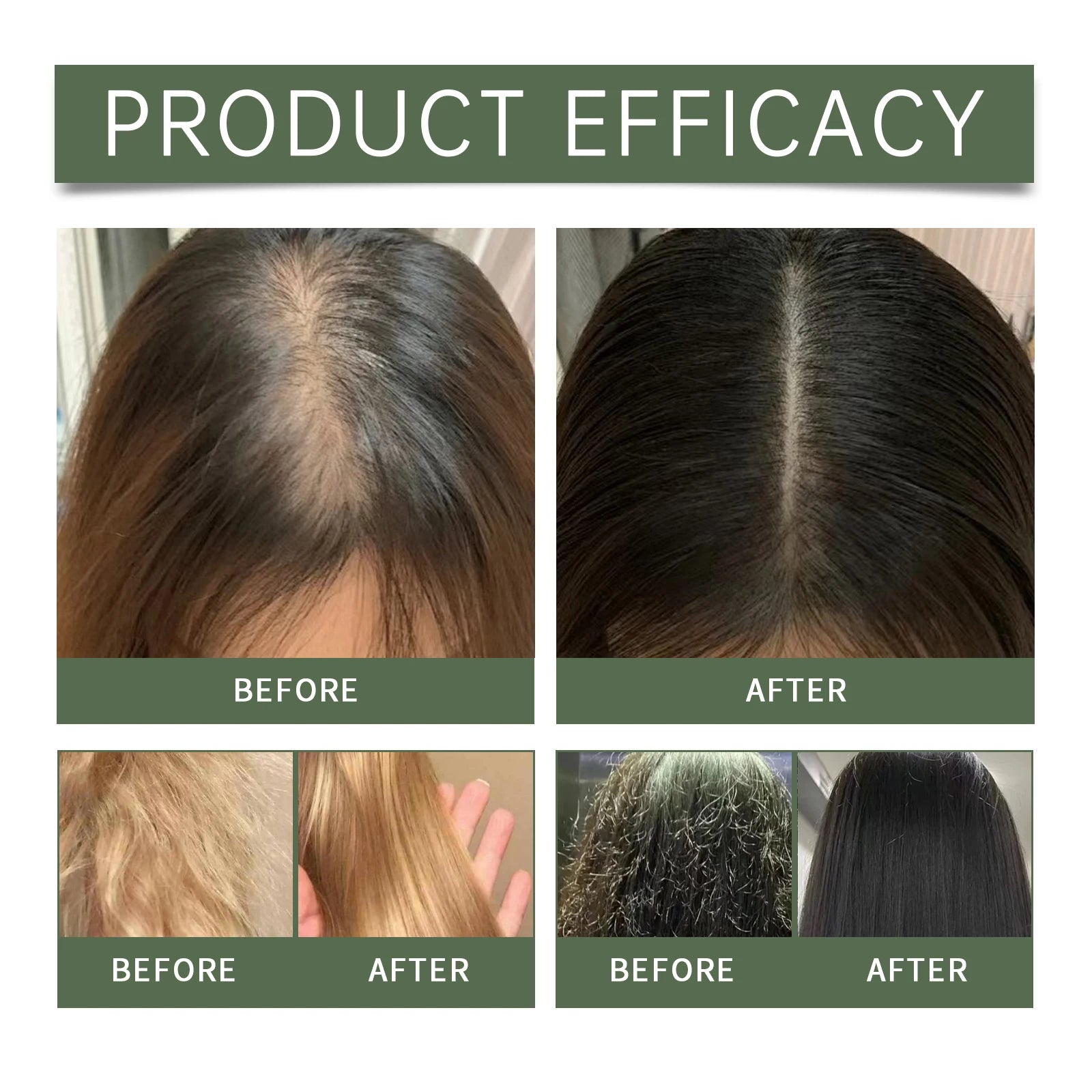 Rosemary Hair Care Set Hair