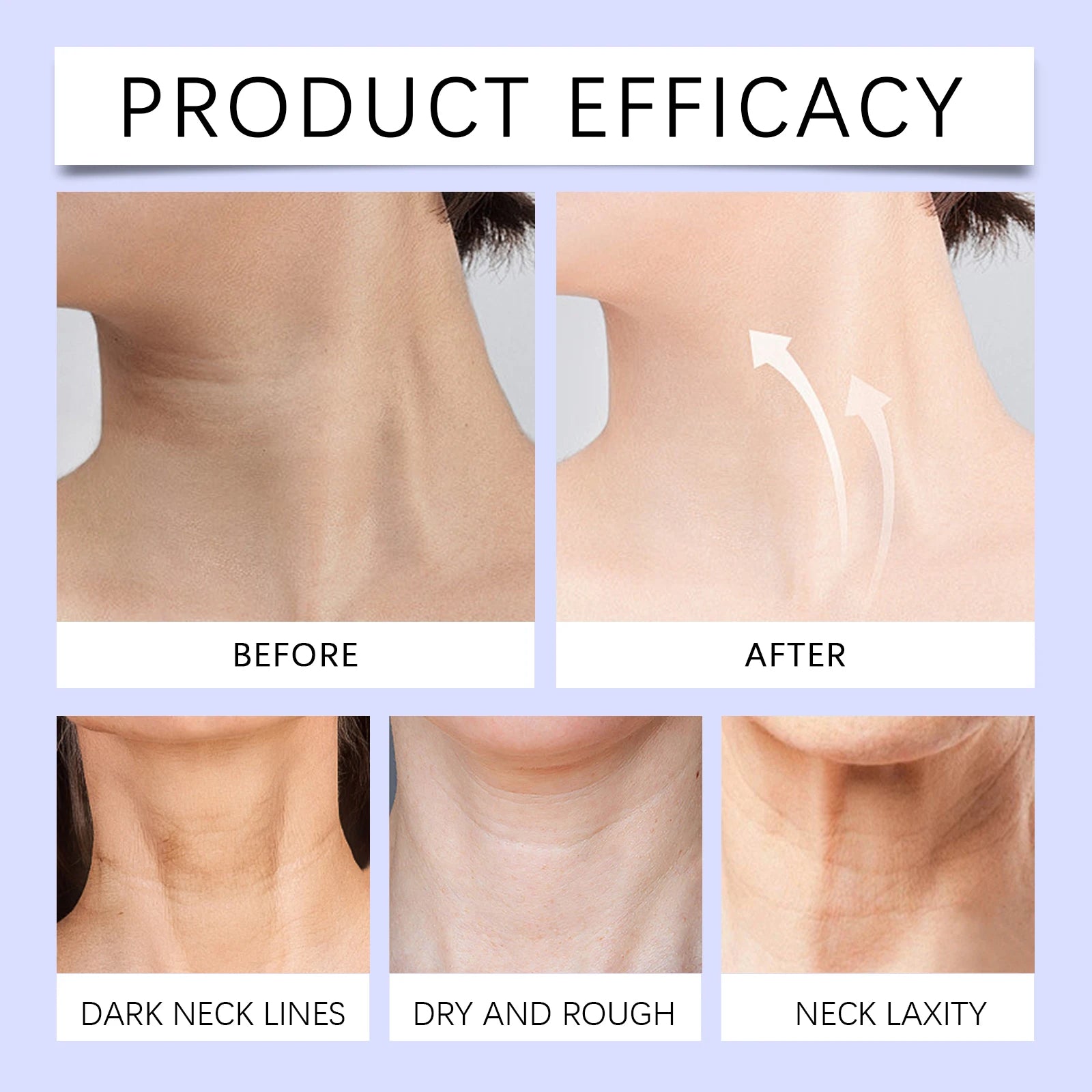 Neck Cream