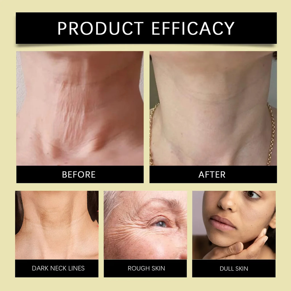Bee Venom Neck Care