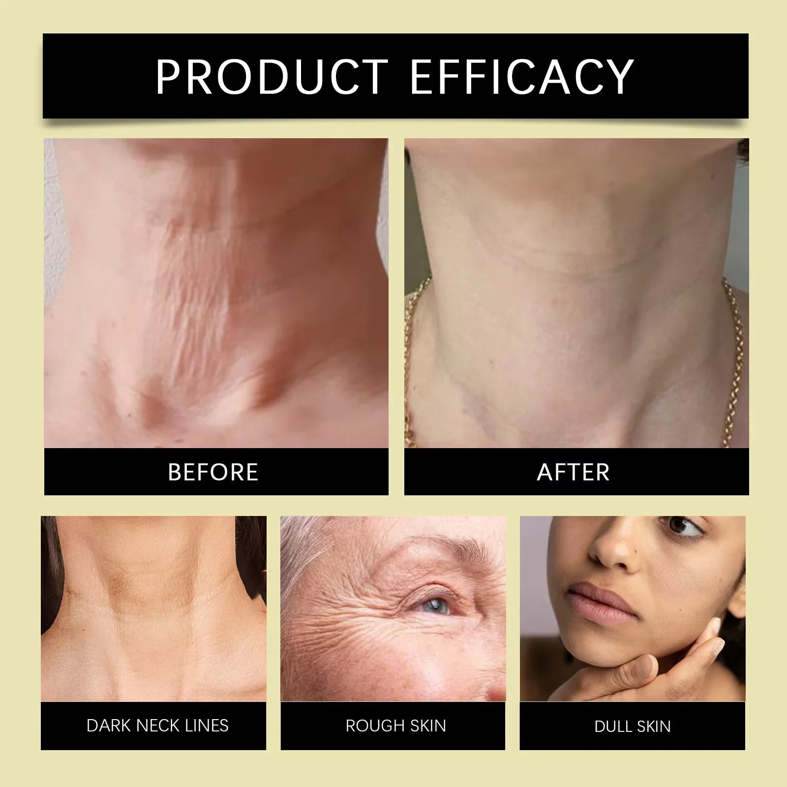 Bee Venom Neck Care